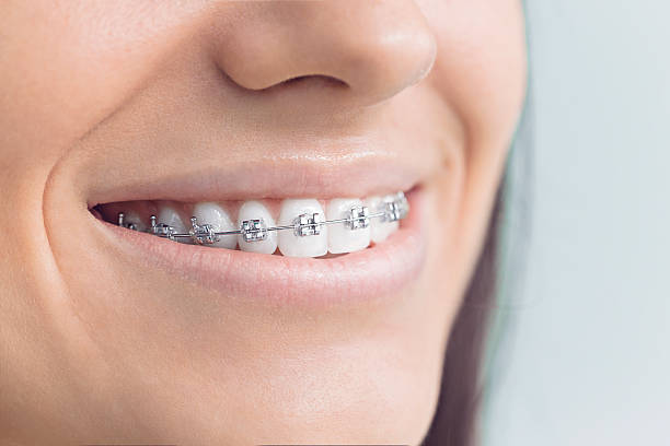 Best Traditional Braces  in Wilson, NC